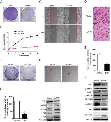 Effects of TPP1 knockdown on HepG2.2.15 cells and its mechanisms. (A ...