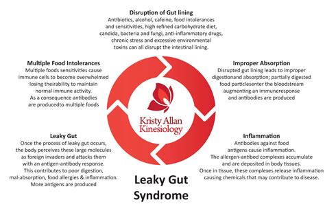 Leaky Gut Syndrome F - Kristy Allan Kinesiology