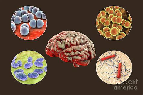 Meningitis Art Pixels