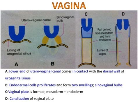 Anomalies of Female Reproductive System (Embryology-uterus, uterine t…