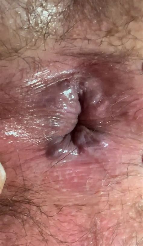 My Ass Hole 7 Nude Pics XHamster