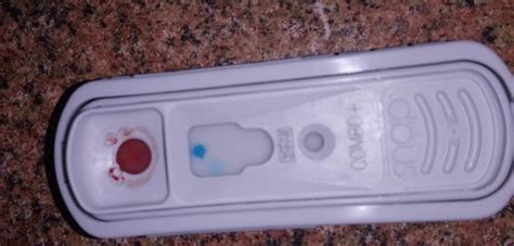 ВИК у кошек - симптомы и лечение вирусного иммунодефицита