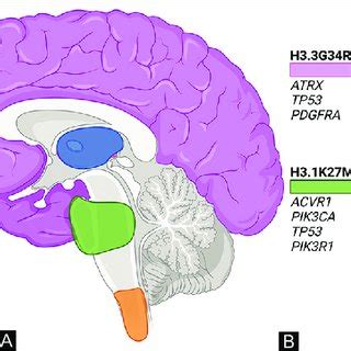 Histone mutation, location, and commonly associated mutations in ... 