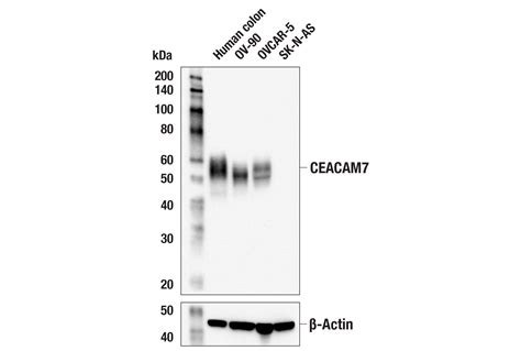 CEACAM7 E5Q6X Rabbit MAb Cell Signaling Technology