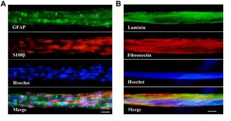 Figure 2 From Chitosan Silk Fibroin Based Schwann Cell Derived