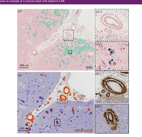 Figure From Sex Differences In Histopathological Markers Of Cerebral