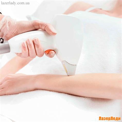 УДАЛИТЬ ВОЛОСЫ на РУКАХ можно с помощью лазерной эпиляции - волосы ...