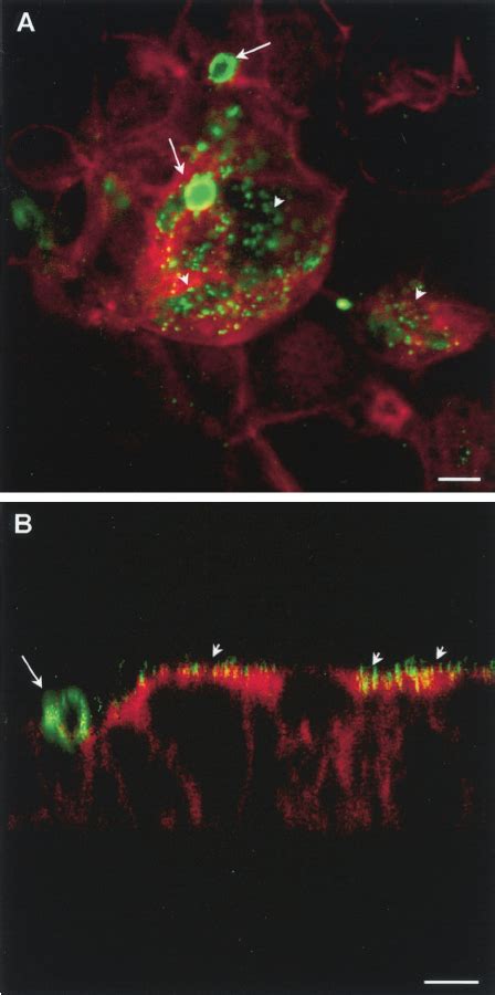 Immuno Fl Uorescence Confocal Microscopy Analysis Of