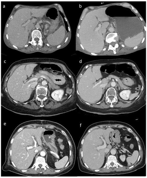 Tomography Free Full Text Computed Tomography Effective Dose And