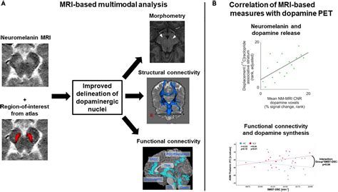 Frontiers Magnetic Resonance Imaging Of The Dopamine System In