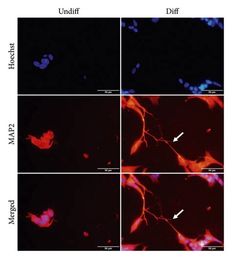 Differentiation of SH-SY5Y cells into a neuronal phenotype. SH-SY5Y ...