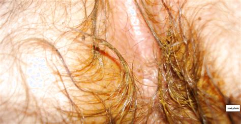 Mon Cul Poilu My Hairy Ass Image ThisVid Tube