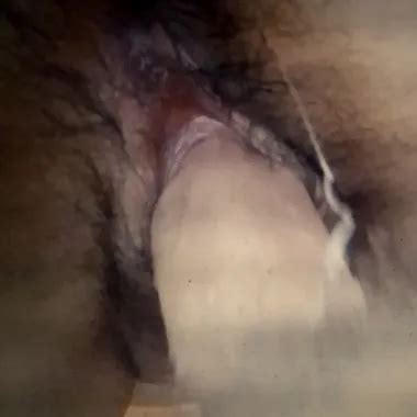 Braz Kiss Slapping Lesbian Lesbian Porn XHamster