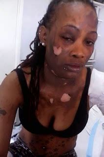 Gay Lesbian Bisexual Transgender Queer Jamaica Jamaican Deported After Beating Ex Lover