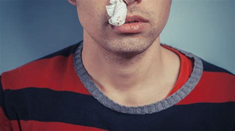 What Causes A Nosebleed? | HuffPost UK Life