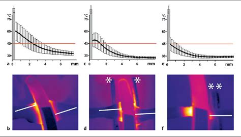 Figure 3 From Thermal Spread Of Vessel Sealing Devices Evaluated In A