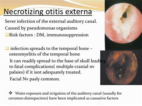 Otological Emergencies