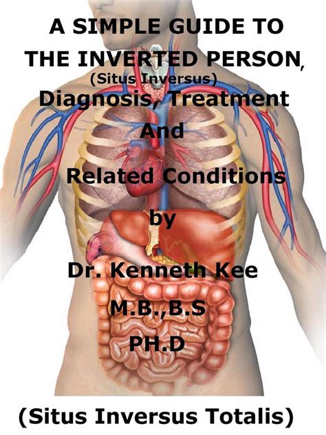 Unraveling The Mystery Of Situs Inversus Life Expectancy And Beyond