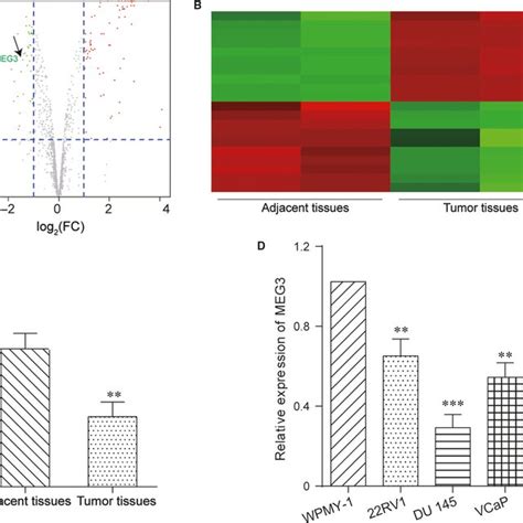 LncRNA MEG3 Was Downregulated In Prostate Cancer A The Volcanic Map