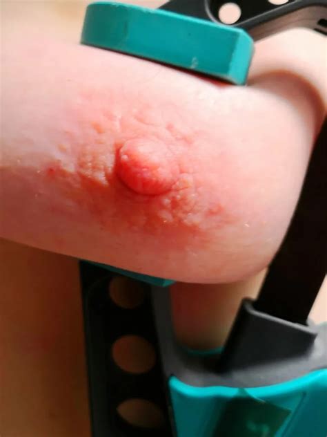 Tits Squeezed With Clamps Nude Pics Xhamster