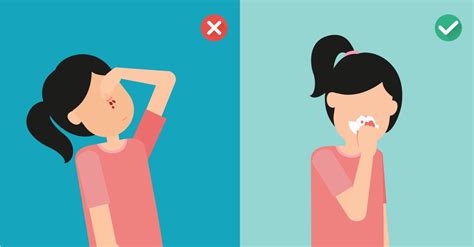 how to fix a bloody nose