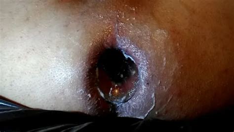 Dilatation Anal Gay Amateur Amateur Porn Feat EL MajiN XHamster