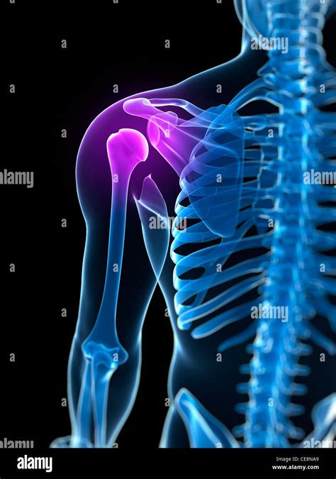 Shoulder Pain Conceptual Computer Artwork Stock Photo Alamy