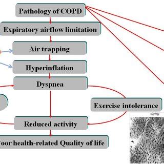 Efficacy of LAMA-LABA therapy in COPD. | Download Scientific Diagram