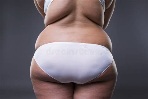 Overweight Woman With Fat Legs And Buttocks Obesity Female Body Stock