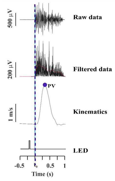 Illustration of deltoid muscle activation, raw and filtered data at 100 ...