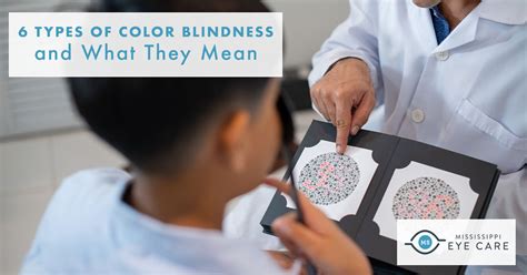 Types Of Color Blindness And What They Mean Mississippi Eye Care