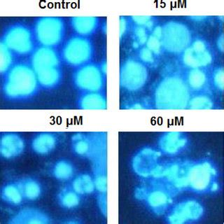 Oridonin Induces Apoptosis In The U Os Cells As Indicated By Dapi