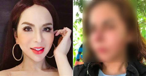 Hot girl Linda chuyển giới chia sẻ ảnh mặt biến dạng sau khi nạo silicon