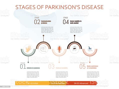 Ilustración De Etapas De La Enfermedad De Parkinson Y Más Vectores