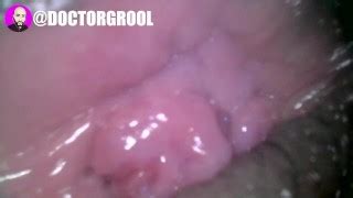 Free Doctor Porn Videos From Thumbzilla