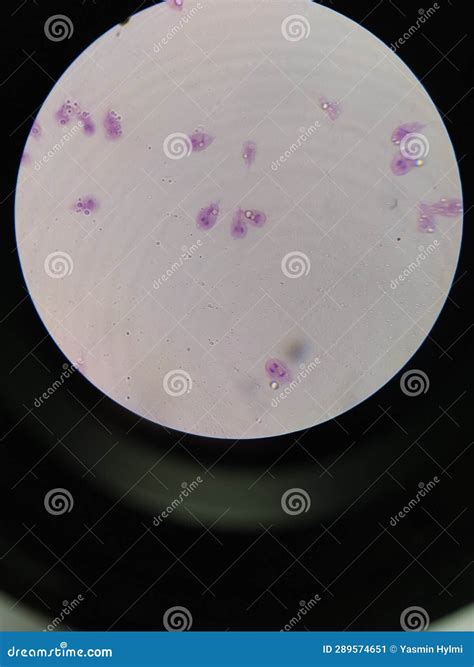 Giardia Lamblia Cyst Stock Image 268926037