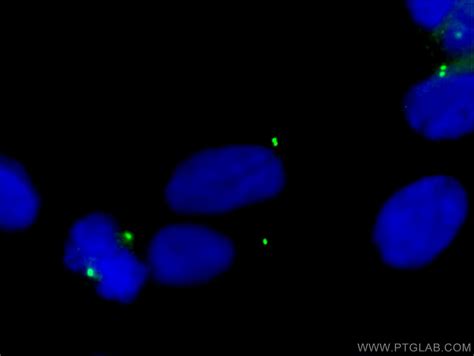 gamma tubulin antibody   ig proteintech
