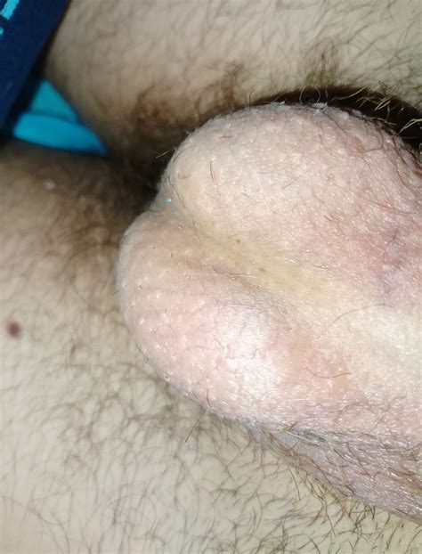 Cock Balls Nude Pics XHamster