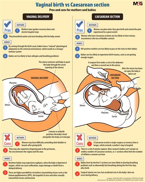 Cesarean Delivery Vs Natural Delivery