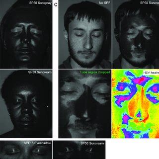 uv imaging reveals facial areas   prone  skin cancer