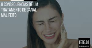 Consequ Ncias De Um Tratamento De Canal Mal Feito Fenelon Endodontia