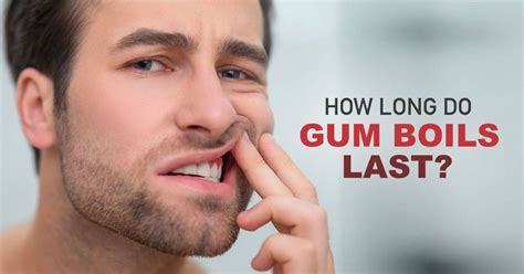 Gum Boils Duration And Remedies Explained