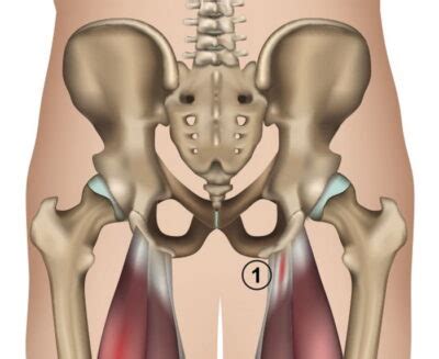 The Runner S Curse Dealing With High Hamstring Tendinopathy