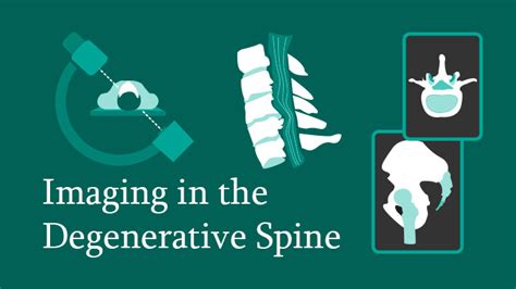 Imaging In The Degenerative Spine — Radiology Course — Eccelearning