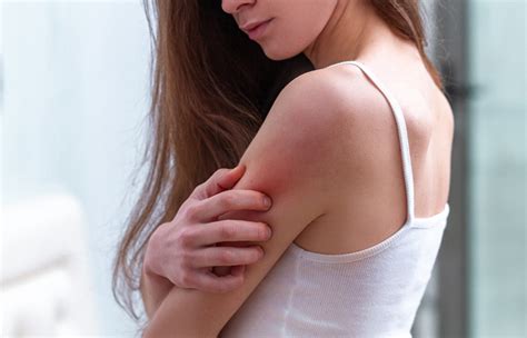 Skin Induration: Symptoms, Causes, And Treatments