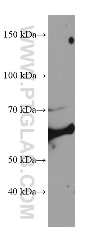 CCT8 antibody 67539 1 Ig Proteintech 武汉三鹰生物技术有限公司