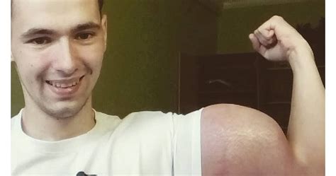 Тъпак се помпа с мазна отрова