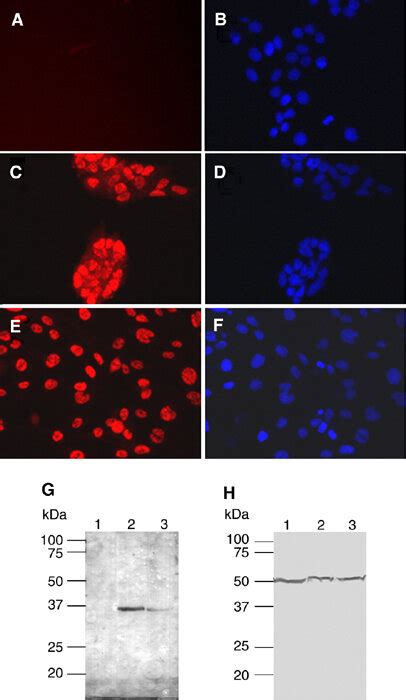 Sox2 Protein Expression In The Glioma Cell Lines U343 And U373