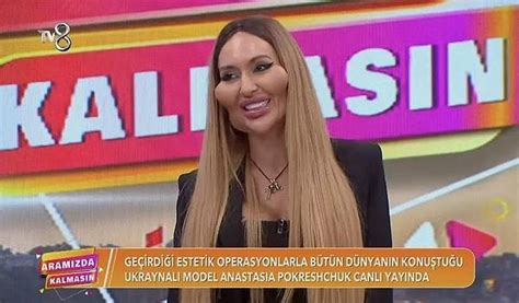 Dünyanın En Büyük Elmacık Kemiğine Sahip Anastasia Pokreshchuk Bu