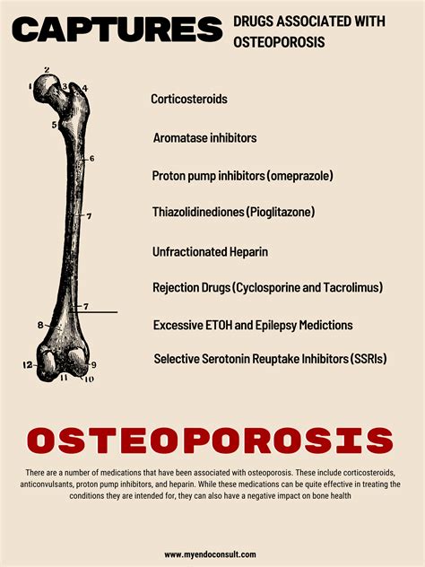 Mnemonic for drugs causing osteoporosis – My Endo Consult